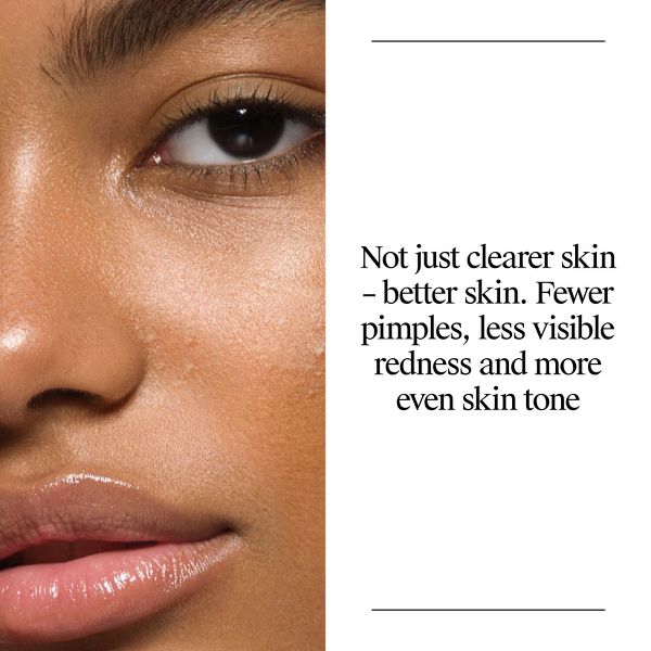 Neutrogena Oil-Free Salicylic Acid Acne Fighting Face Wash - 9.1oz