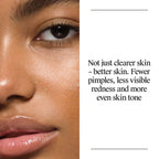 Neutrogena Oil-Free Salicylic Acid Acne Fighting Face Wash - 9.1oz