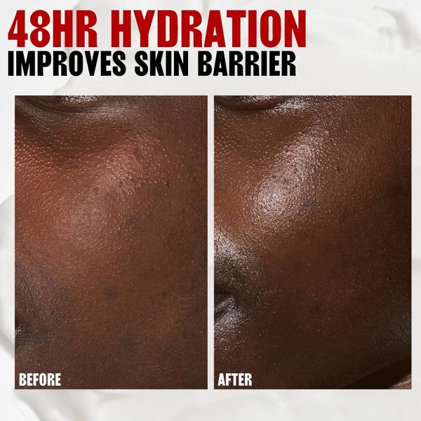 Thayers Natural Remedies Milky Hydrating Face Toner with Snow Mushroom and Hyaluronic Acid - 12 fl oz